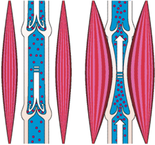 spierpomp